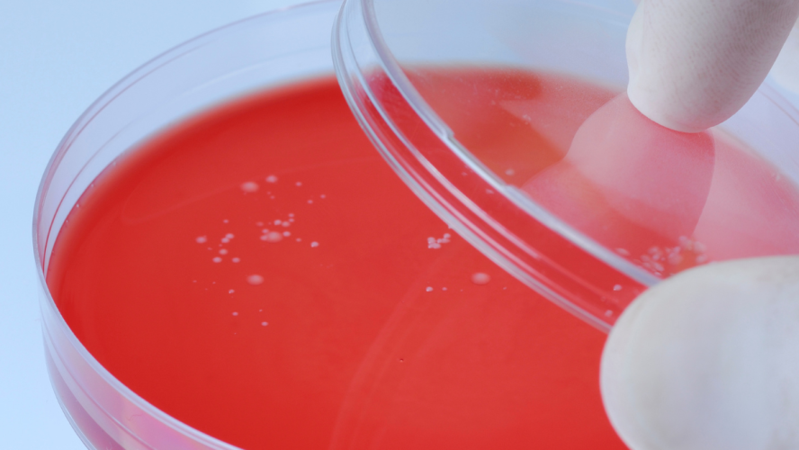 A Ciência do Cultivo Microbiano: Como Manejar Placas de Petri e Meios de Cultura no Laboratório